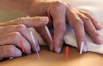 Chiropratic Center - Foto 1