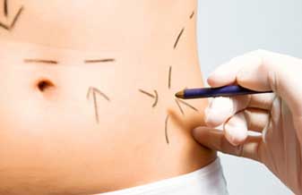 Silvio Michalany Filho - Foto 1