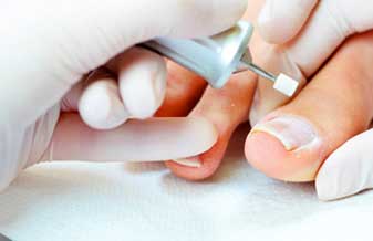 Doctor Feet - Foto 1