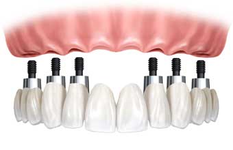 Laboratório PINI - Foto 1